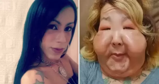 Una Cirugía Estética que Jamás Olvidará