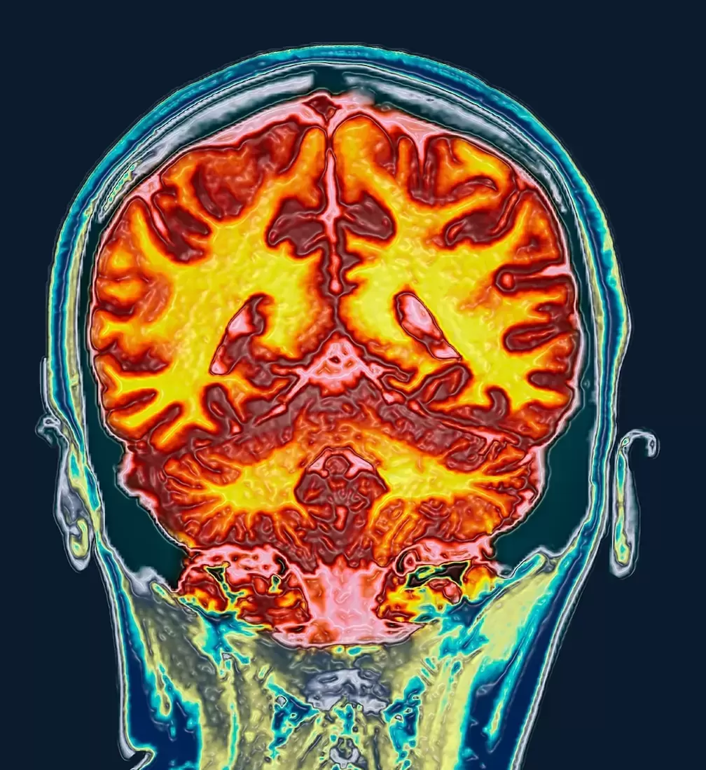 La menstruación y su impacto en el cerebro de las mujeres: un estudio revela cambios significativos
